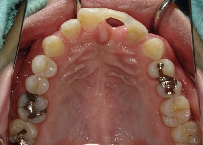 矯正歯科