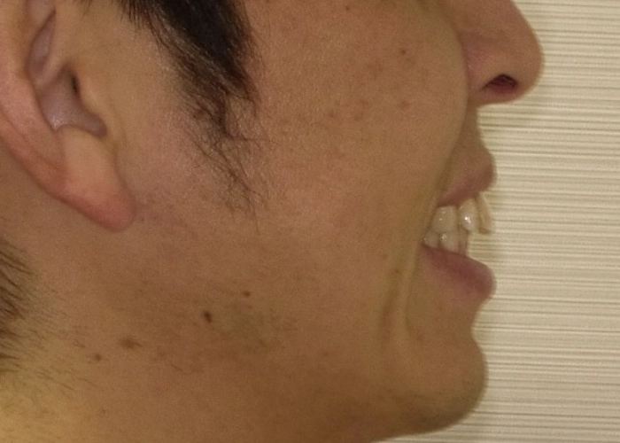 矯正歯科