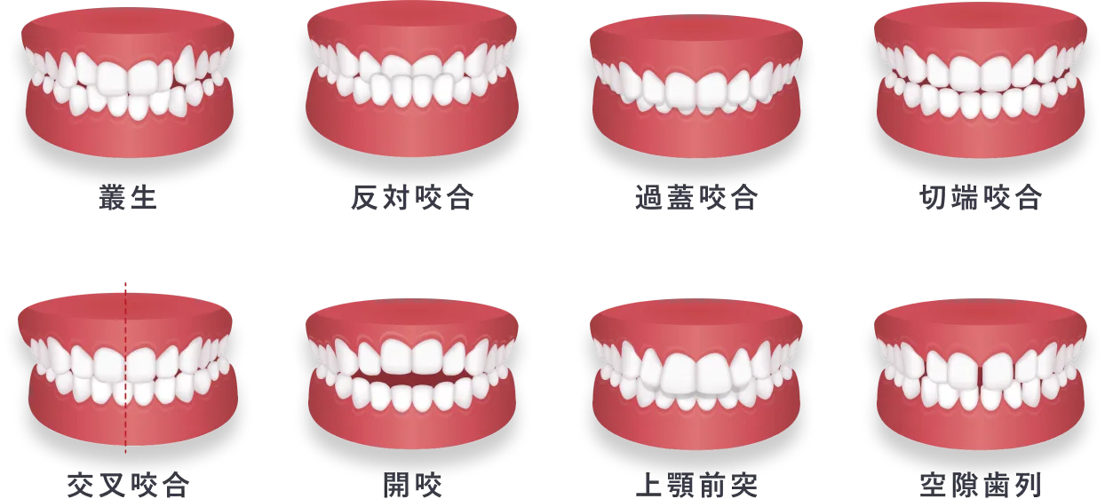 どんな歯並びでも綺麗な歯並びに
